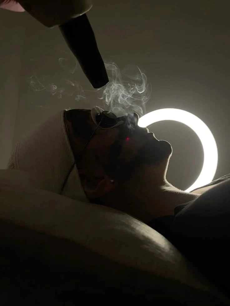 Карбоновый пилинг — результат процедуры