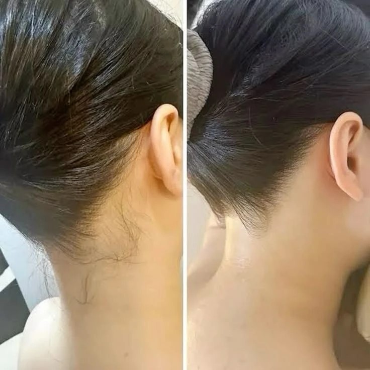 Результат женской депиляции