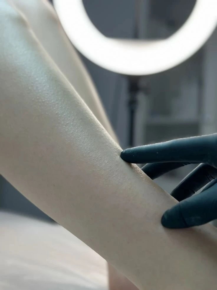 Результат женской депиляции